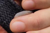 Arion intermedius